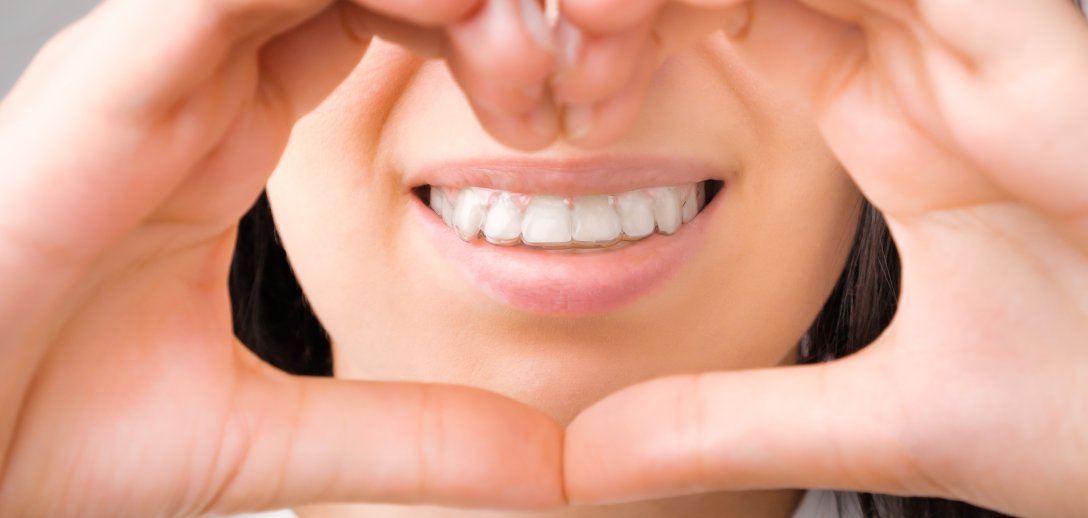 Naturalne metody na nadwrażliwe zęby – ziołowe płukanki, domowy lakier chroniący szkliwo, przeciwbólowe wcierki