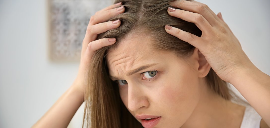 Jak powstrzymać wypadanie włosów – domowe sposoby polepszą ukrwienie skóry głowy i wzmocnią  cebulki