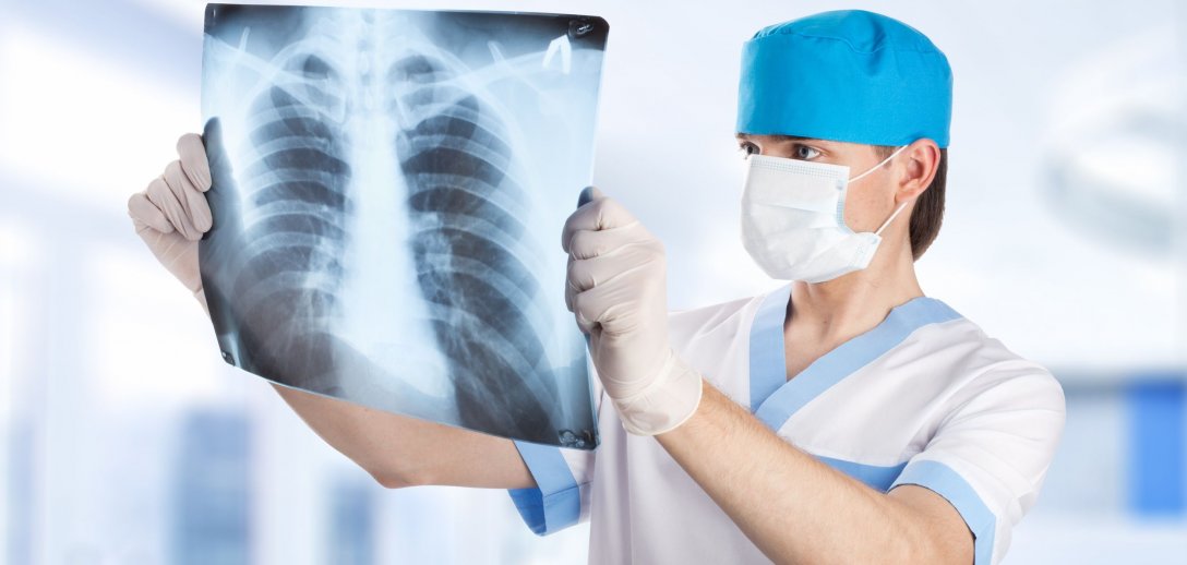 Zapalenie płuc może mieć różne przyczyny. Jakie są objawy i sposoby leczenia w zależności od rodzaju choroby?