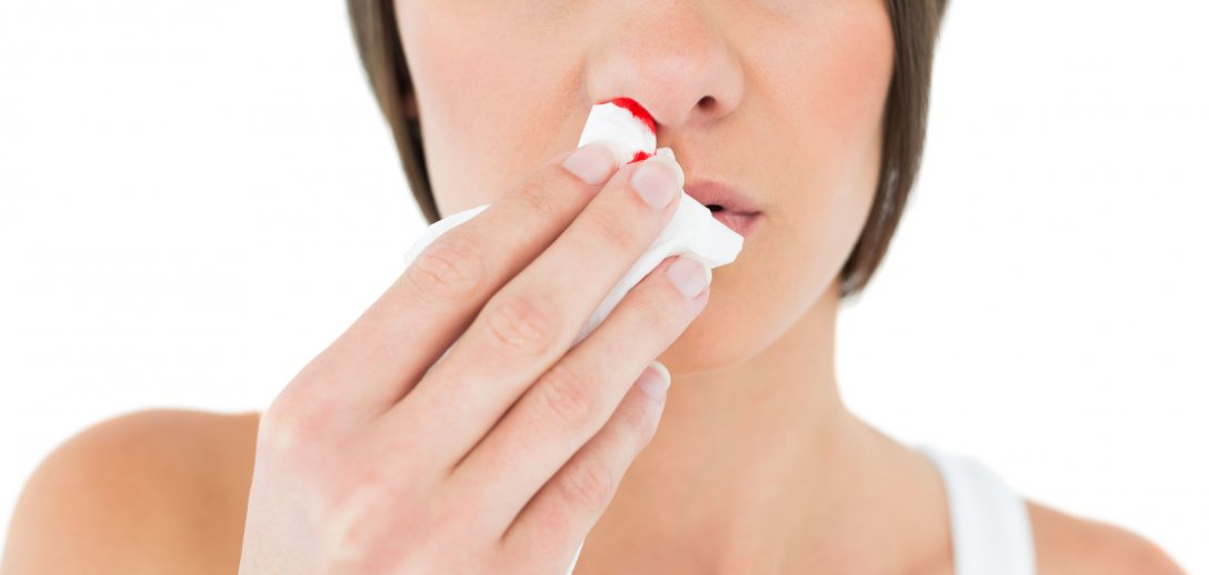 Krwawienie  z nosa może być objawem problemów ze zdrowiem. Jak zatamować krwotok z nosa?