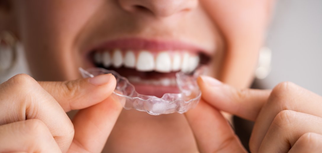 Jak poradzić sobie z bruksizmem? 6 sposobów na zgrzytanie zębami