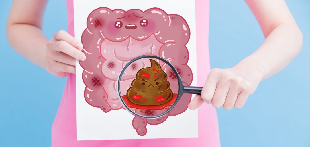 Wypróżnienia: co kolor i konsystencja stolca mówią o Twoim zdrowiu