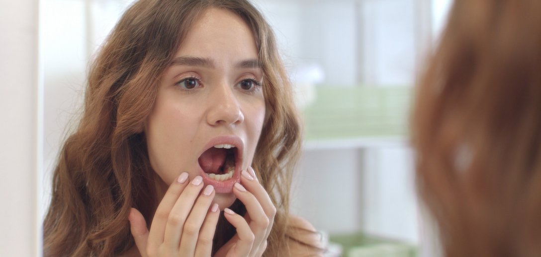 Czemu krwawią dziąsła? Sprawdź przyczyny dolegliwości i domowe sposoby leczenia