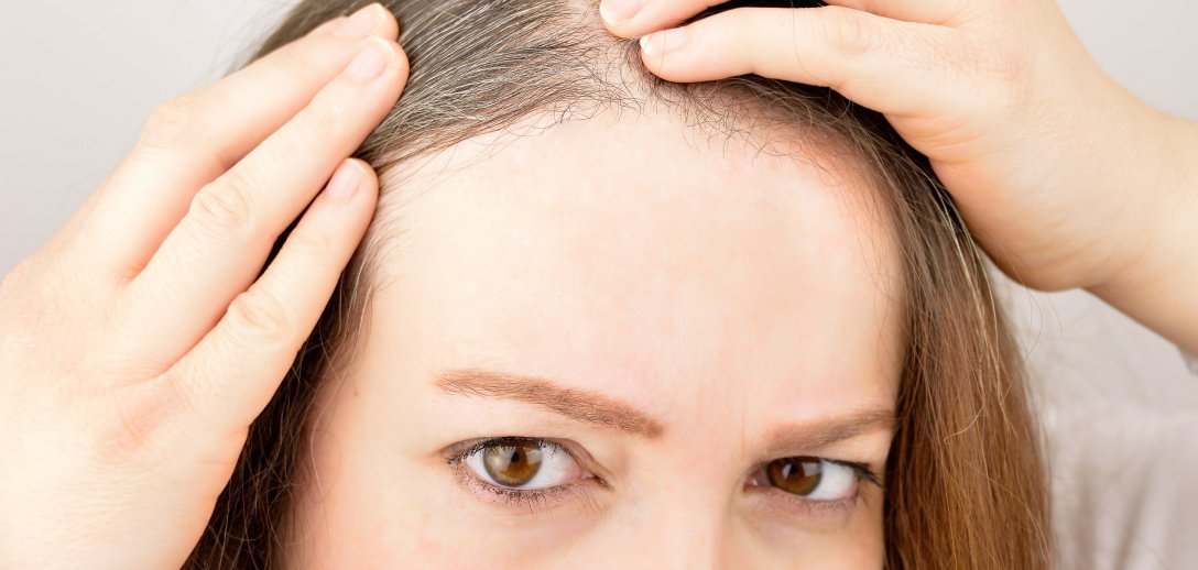 Dlaczego włosy nagle siwieją? Przyczyną może być nie tylko wiek! Sprawdź, co może oznaczać ten objaw