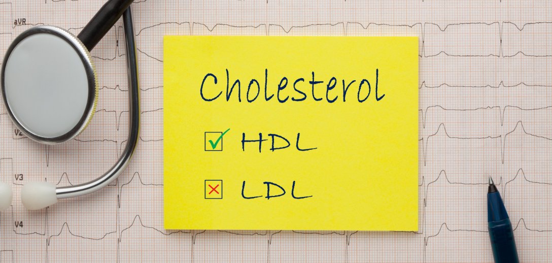 Dobry i zły cholesterol – co to jest? Normy cholesterolu LDL i HDL