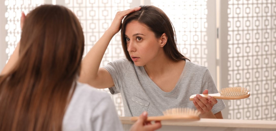 Czy łysienie plackowate można wyleczyć? Sprawdź, jak sobie z nim radzić