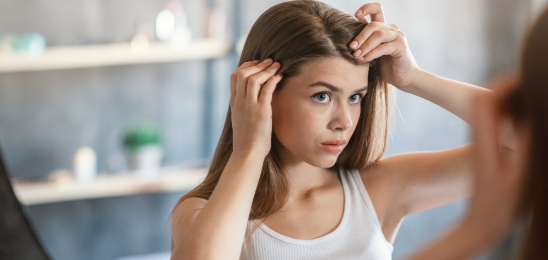 Łupież nawraca lub nasila się zimą? Wypróbuj te naturalne i skuteczne metody